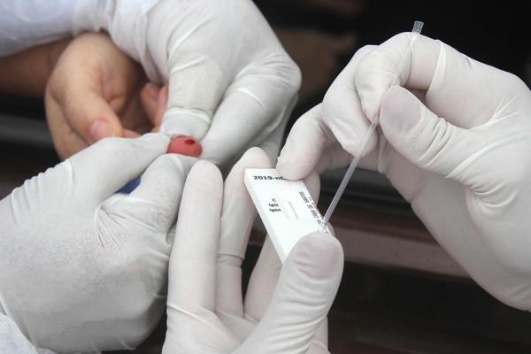 Jundiaí passa a realizar 450 testes rápidos do novo coronavírus por dia 